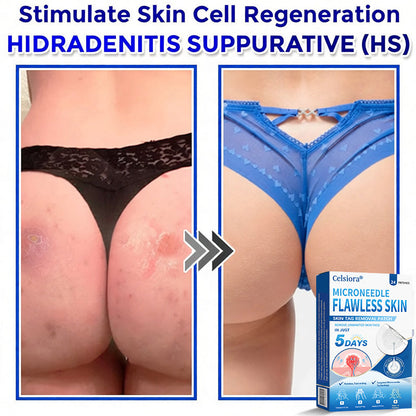 👑👑Celsiora® 2-in-1 Microneedle & Hydrocolloid Patch | Raised Moles,Acne, Flat Warts & Skin Tags Remover | Improves Wrinkles, Scars & Blemishes | Invisible Pimple Patches for Face & Body | 24 Count
