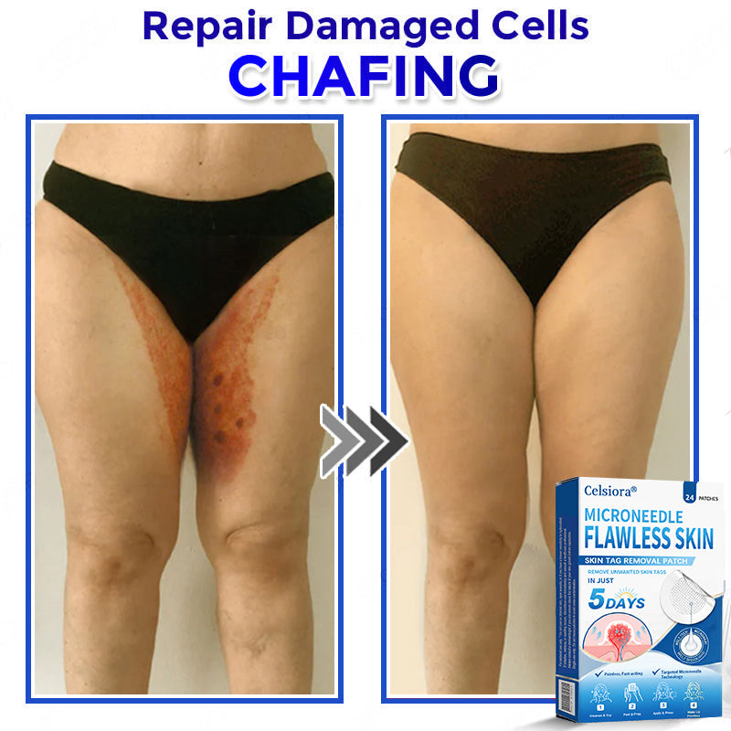 👑👑Celsiora® 2-in-1 Microneedle & Hydrocolloid Patch | Raised Moles,Acne, Flat Warts & Skin Tags Remover | Improves Wrinkles, Scars & Blemishes | Invisible Pimple Patches for Face & Body | 24 Count