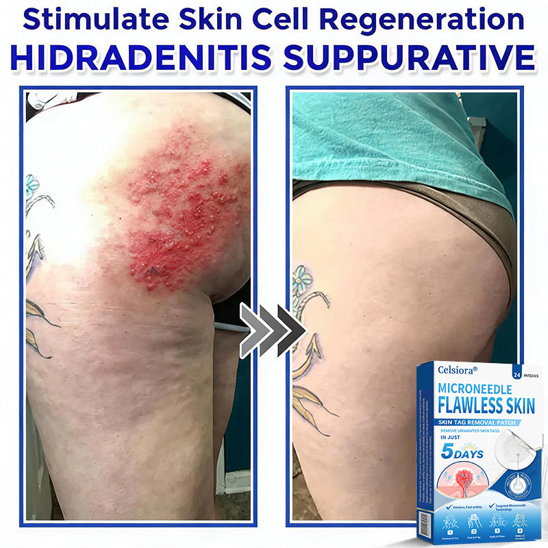 👑👑Celsiora® 2-in-1 Microneedle & Hydrocolloid Patch | Raised Moles,Acne, Flat Warts & Skin Tags Remover | Improves Wrinkles, Scars & Blemishes | Invisible Pimple Patches for Face & Body | 24 Count