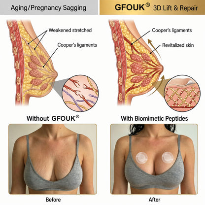 🇺🇸🏆GFOUK® ✨BREAST VOLUME BOOST & FIRM Advanced Nano Microneedle Patch💖