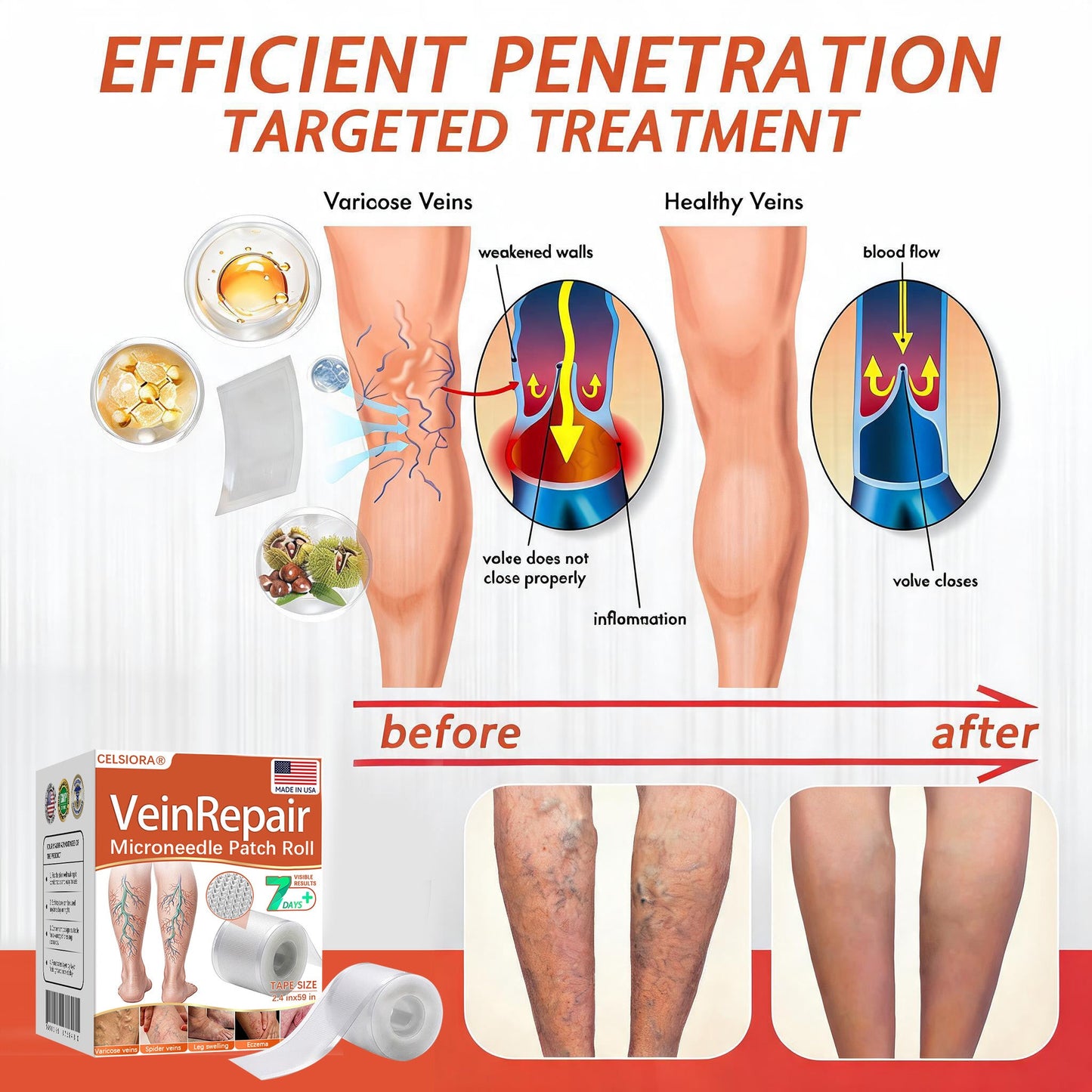 🌿🌿Official US Store 🇺🇸 | Celsiora® Vein Ease Microneedle Care Patch(For Spider Veins, Varicose Veins, Swelling & Leg Fatigue) - Last Day Promotion 50% OFF