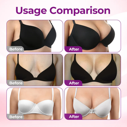 🇺🇸🏆GFOUK® ✨BREAST VOLUME BOOST & FIRM Advanced Nano Microneedle Patch💖