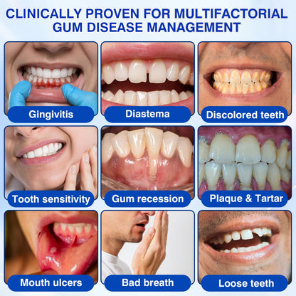🇺🇸👨‍⚕️✅🦷Evolvion® GumRevive Periodontal Repair Gel
