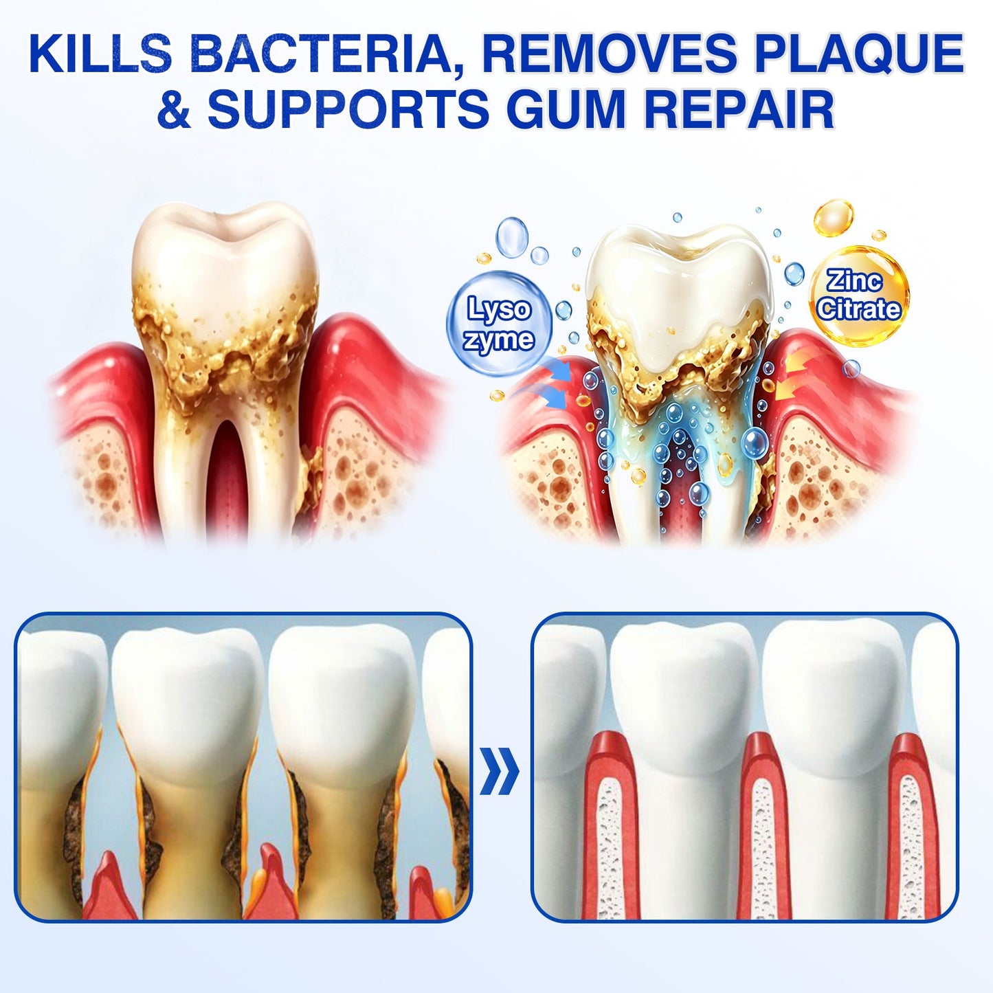 🇺🇸👨‍⚕️✅🦷Evolvion® GumRevive Periodontal Repair Gel