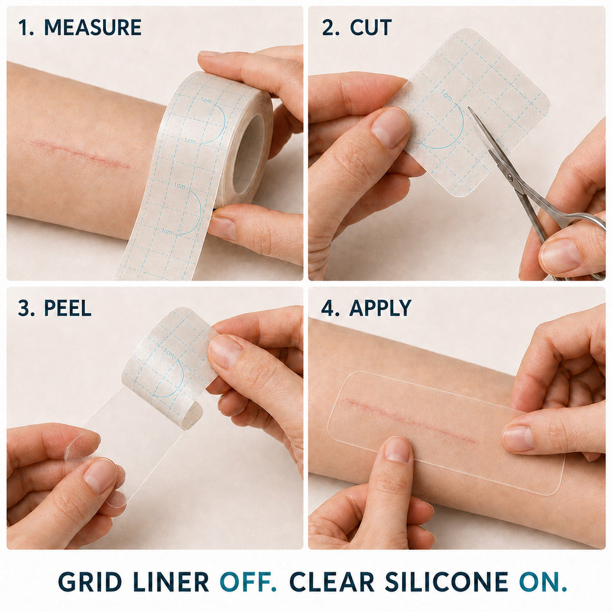 🇺🇸👩‍⚕️✨Trilumia® Silicone Scar Therapy Roll — Custom-Fit Care for Long, Raised Surgical Scars