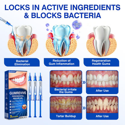 🇺🇸👨‍⚕️✅🦷Evolvion® GumRevive Periodontal Repair Gel
