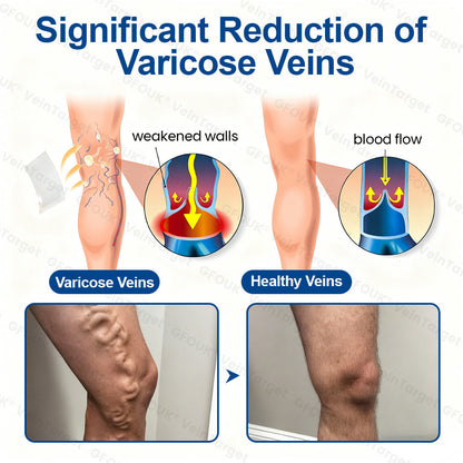 🇺🇸✅👨‍⚕️GFOUK® VeinTarget Microneedle Patch⚡Instant Relief, Long-Term Results