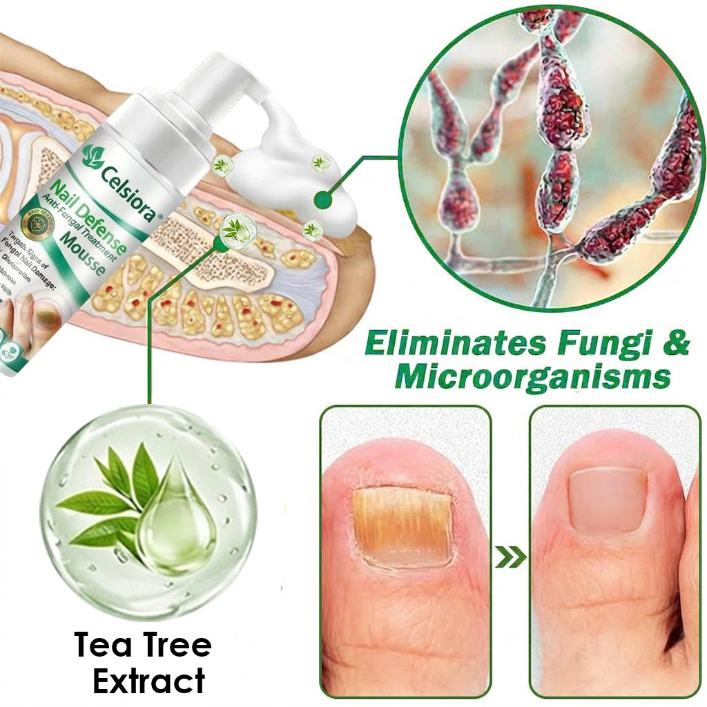 Celsiora® Max Strength Nail Defense Anti-Fungal Treatment Mousse
