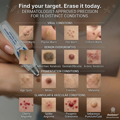 ✨Evolvion® 𝟕-𝐃𝒂𝘆 𝐒𝗸𝐢𝐧 𝐓𝒂𝗴 & 𝐒𝐩𝙤𝐭 𝐄𝐫𝒂𝐬𝙚𝐫 Painless & Scar-Free Advanced Imperfection Remova𝗜 Ro𝗜𝗜erba𝗜𝗜 Pen 🌵 🌵