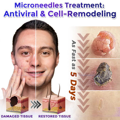 👑👑Celsiora® 2-in-1 Microneedle & Hydrocolloid Patch | Raised Moles,Acne, Flat Warts & Skin Tags Remover | Improves Wrinkles, Scars & Blemishes | Invisible Pimple Patches for Face & Body | 24 Count
