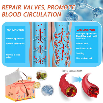 🌿🌿Official US Store 🇺🇸 | Celsiora® Vein Ease Microneedle Care Patch(For Spider Veins, Varicose Veins, Swelling & Leg Fatigue) - Last Day Promotion 50% OFF