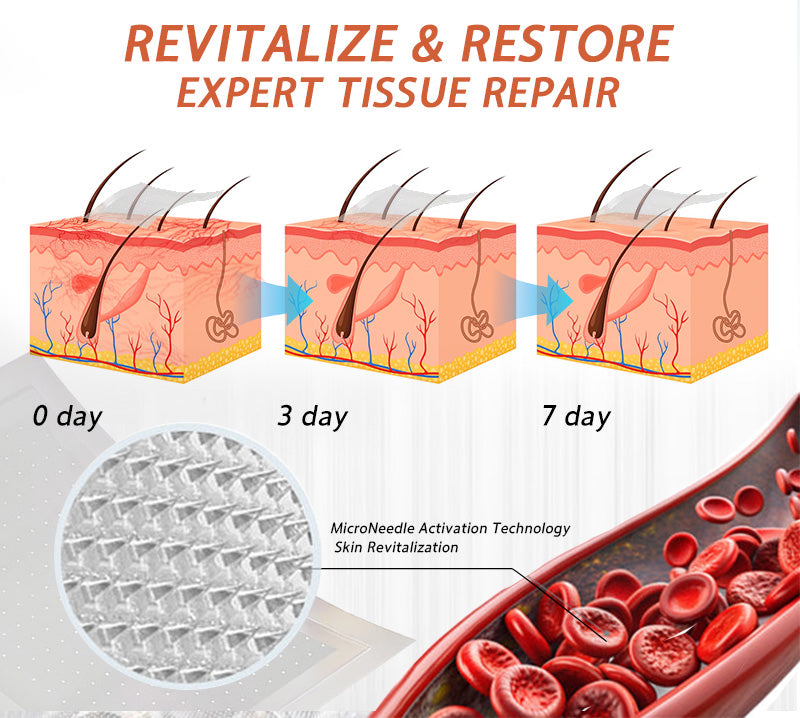 🌿🌿Official US Store 🇺🇸 | Celsiora® Vein Ease Microneedle Care Patch(For Spider Veins, Varicose Veins, Swelling & Leg Fatigue) - Last Day Promotion 50% OFF