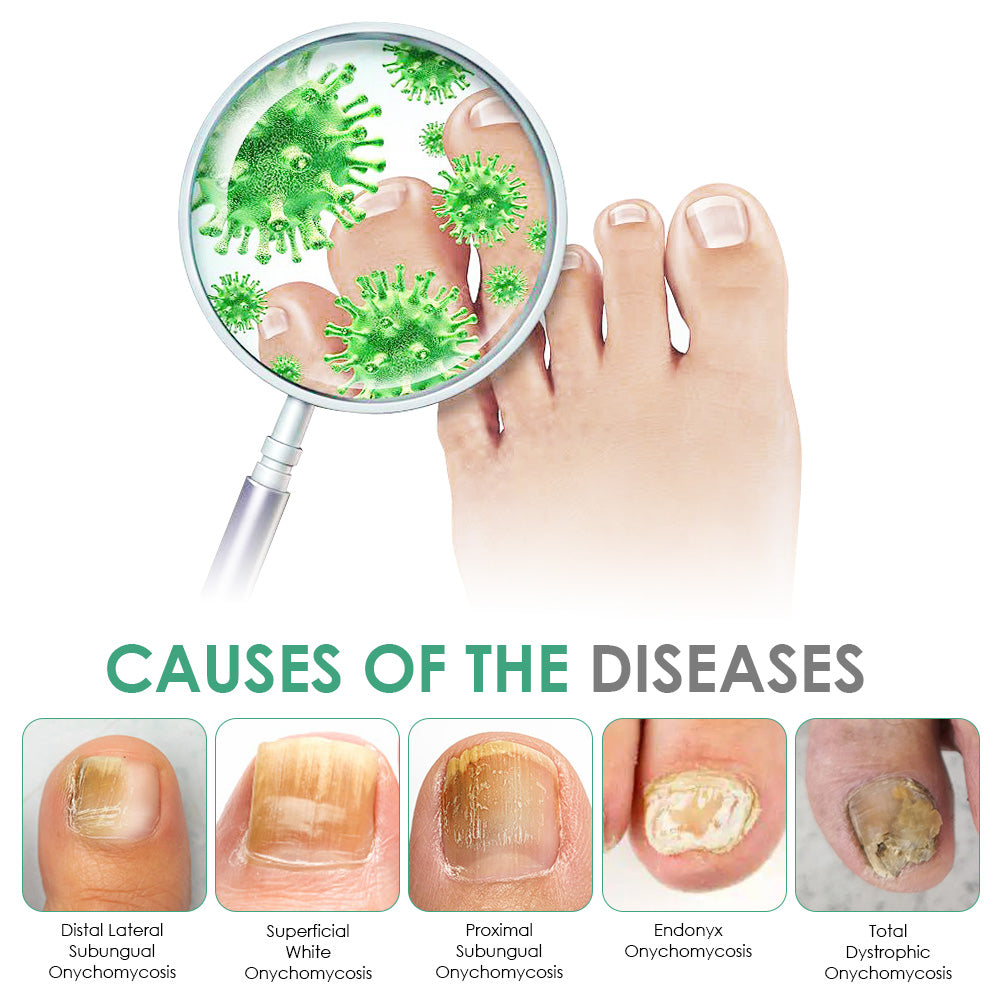 Celsiora® Max Strength Nail Defense Anti-Fungal Treatment Mousse