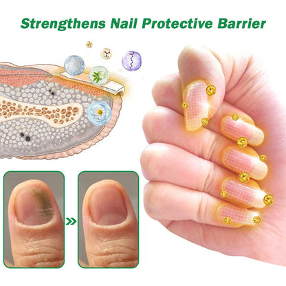Celsiora® Max Strength Nail Defense Anti-Fungal Treatment Mousse