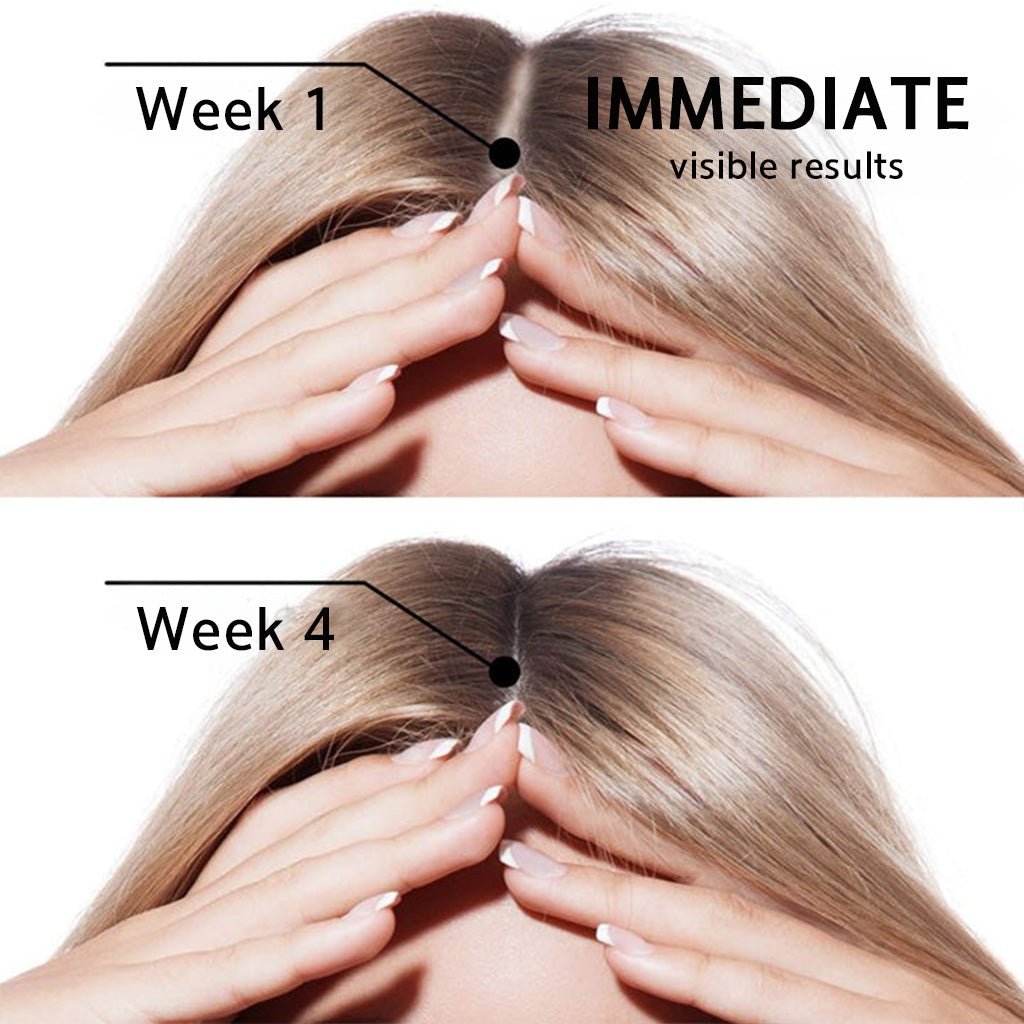 👨‍⚕️🔥Official US Store 🇺🇸 | 🔥Rolimey® Highly Effective Biotin & Rosemary Hair Growth Serum — Visibly fills thinning areas & receding hairlines (🔥 Limited-Time Offer, ⏳ Last 30 Minutes)
