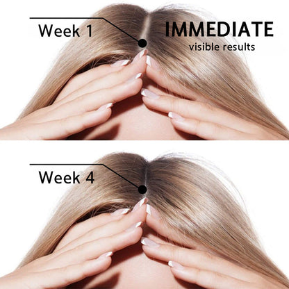 👨‍⚕️🔥Official US Store 🇺🇸 | 🔥Rolimey® Highly Effective Biotin & Rosemary Hair Growth Serum — Visibly fills thinning areas & receding hairlines (🔥 Limited-Time Offer, ⏳ Last 30 Minutes)