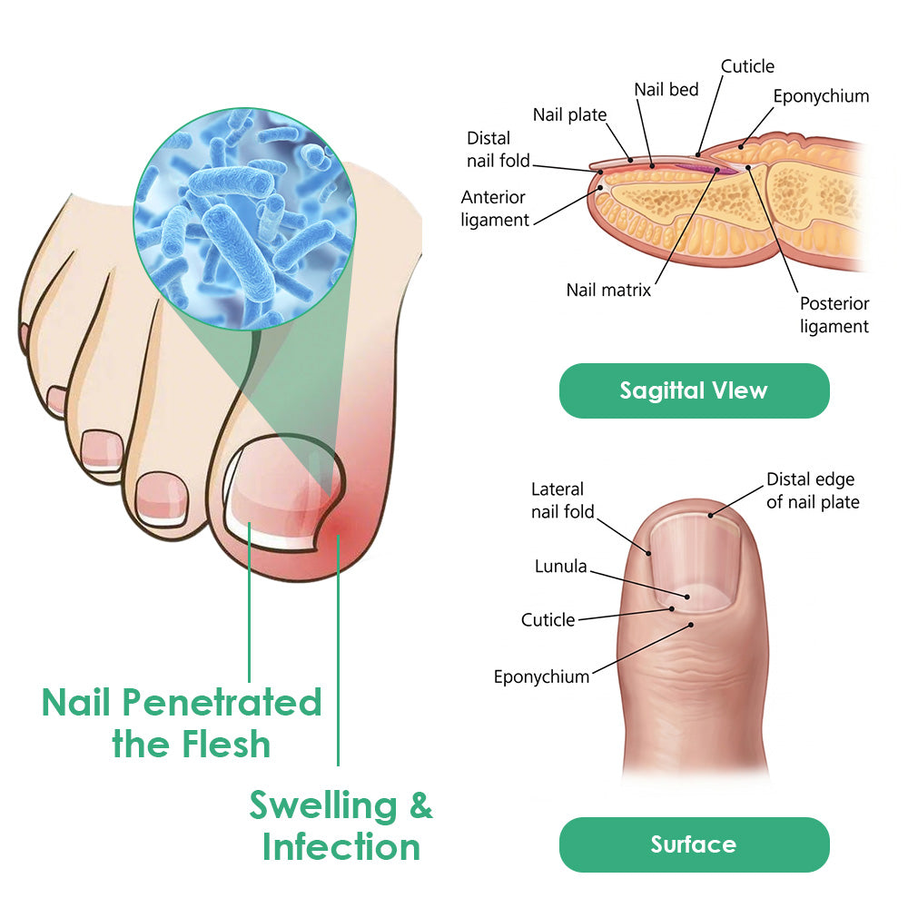Celsiora® Max Strength Nail Defense Anti-Fungal Treatment Mousse